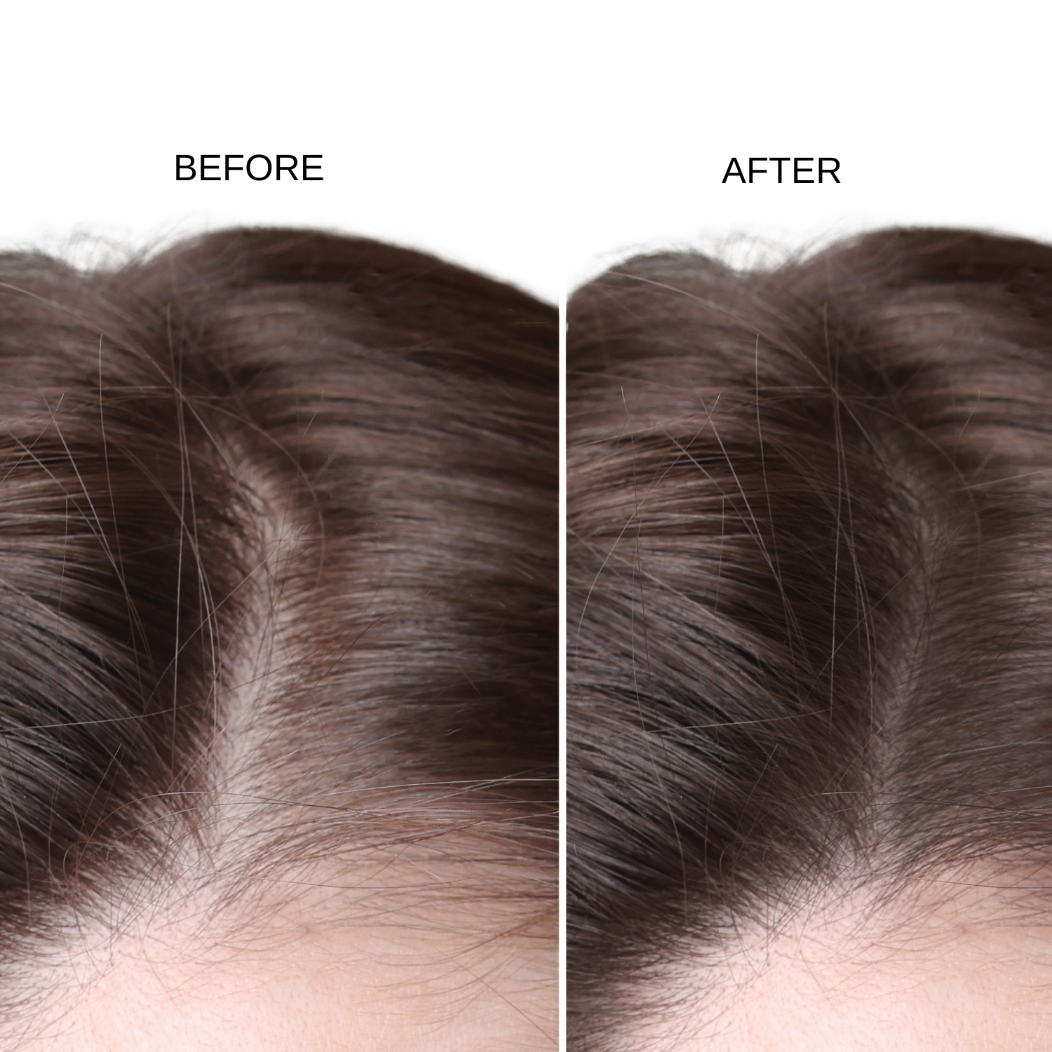 Anti-Hairfall & Hair Growth Booster Serum Shots (10 VIALS) X 2