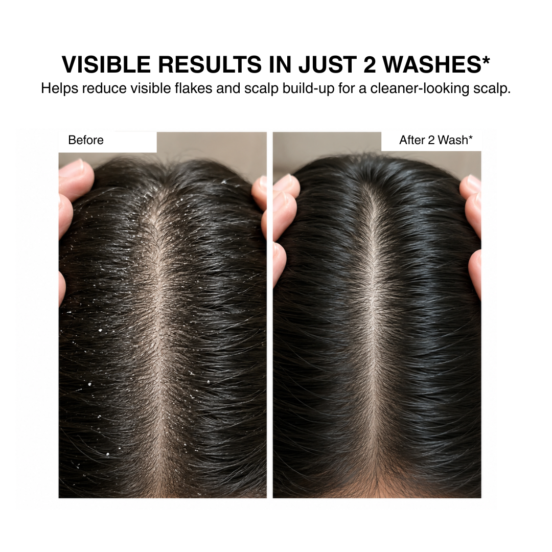 Hair Cleansing and Vitalising Shampoo (250 ML ) + Vitalising Hair Mask (200 GMS)
