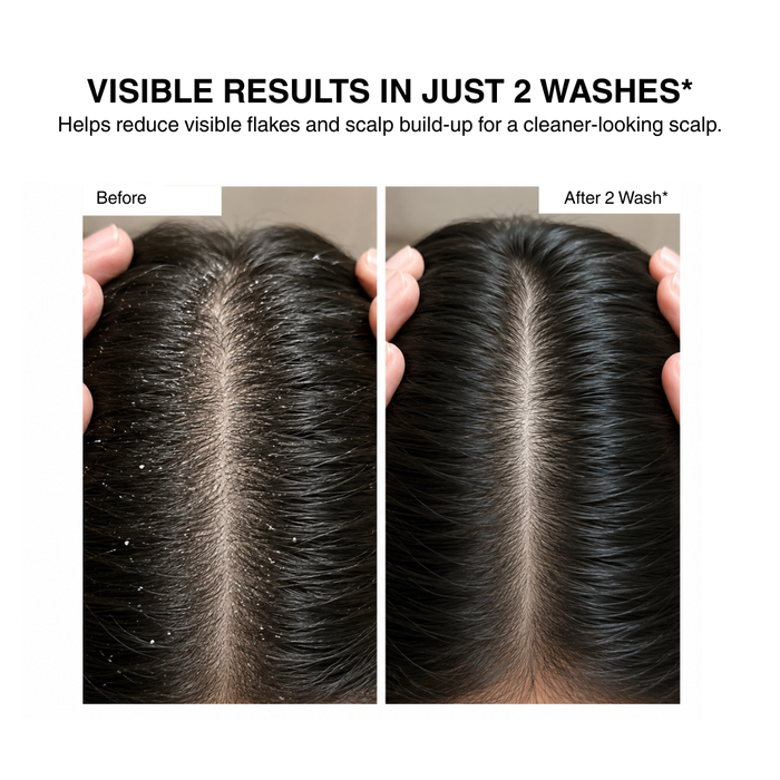 DANDRUFF CONTROL DUE - Hair Cleansing and Vitalising Shampoo (250 ML ) + Vitalising Hair Mask (200 GMS)