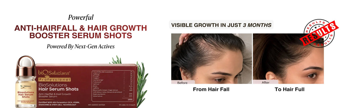 Anti-Hairfall & Hair Growth Booster Serum Shots (10 VIALS) Banner 1