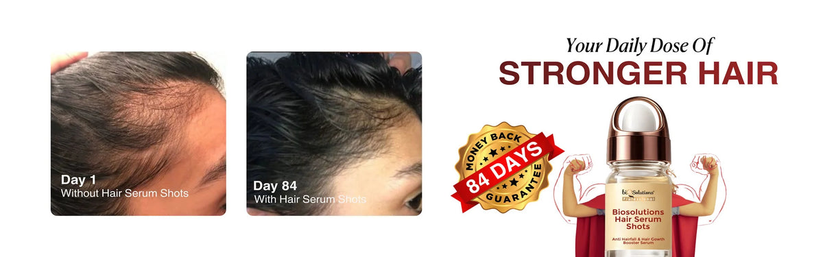 Anti-Hairfall & Hair Growth Booster Serum Shots (10 VIALS) Banner 3