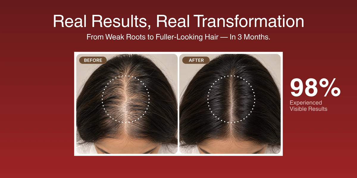 Anti-Hairfall & Hair Growth Booster Serum Shots (5 VIALS) Banner 3