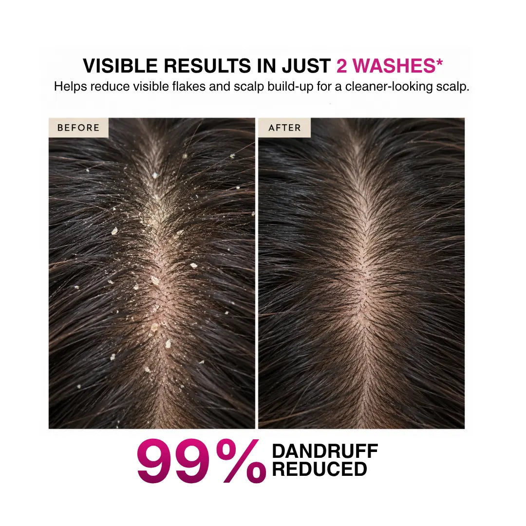 Dandruff Control and Vitalising Hair Mask 500 gms